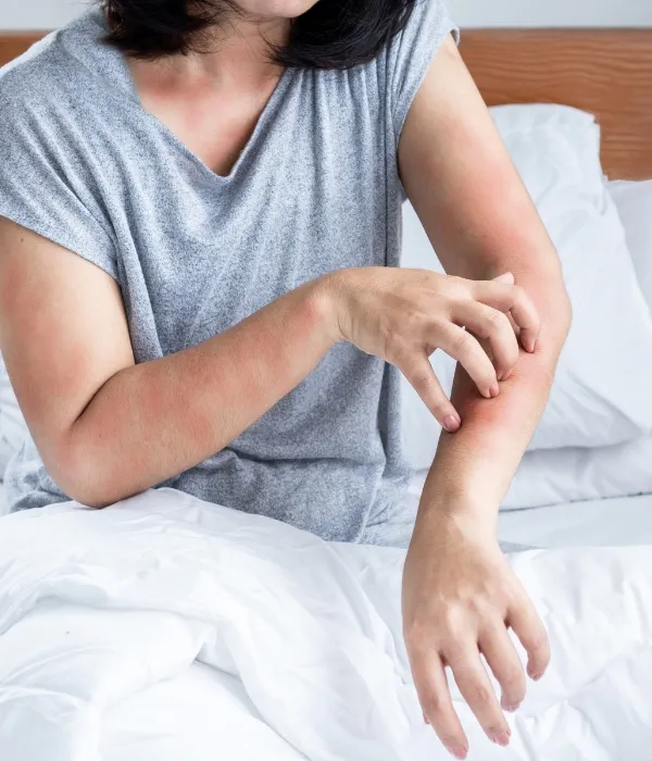 Access Anti Nuisibles - Traitement Punaises de Lit dans le 92 (3)